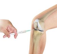 Cortisone Injection