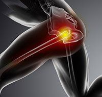 Physical Therapy